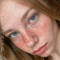 Аляскафрекълс Аляскафоун Голи