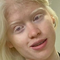 Гуада Скарионе Голи