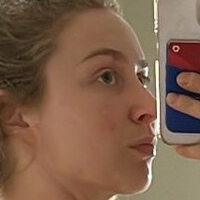 Супорсоник_ Голи